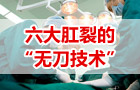 医博（YEBO）治疗肛裂的六大“无