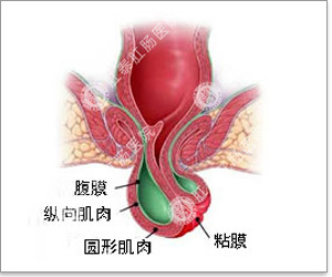脱肛的症状和危害